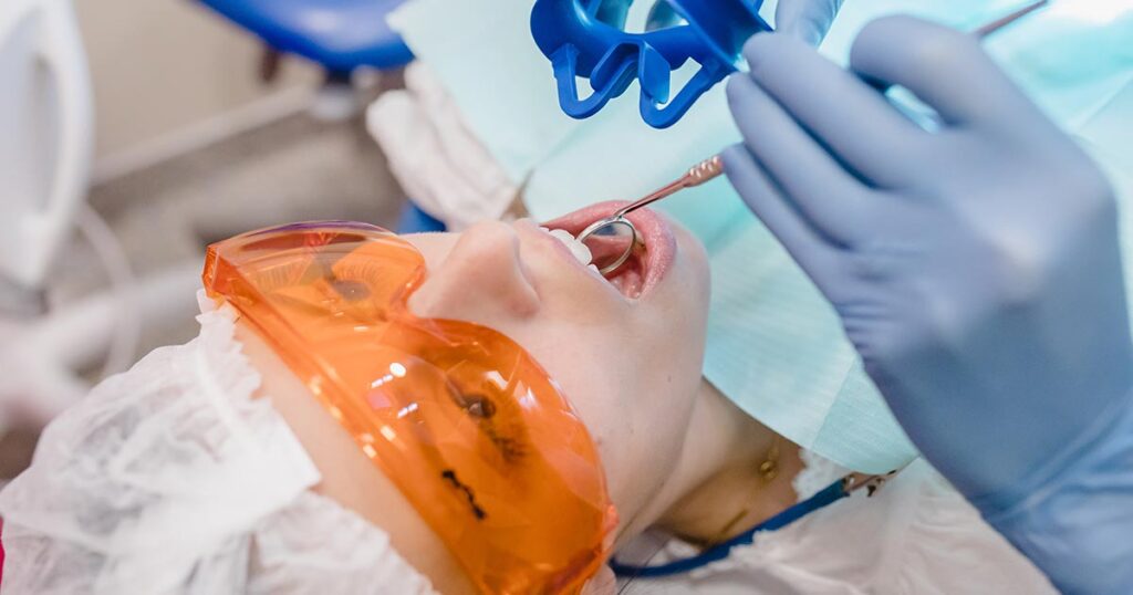 como fazer branqueamento de dentes