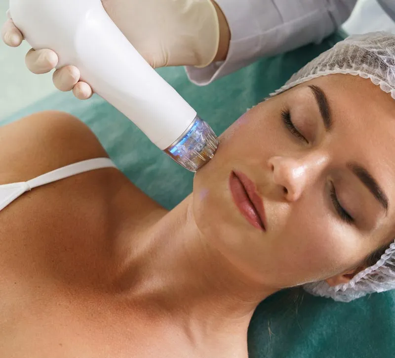 Harmonização Orofacial, tratamento de bioestimulação