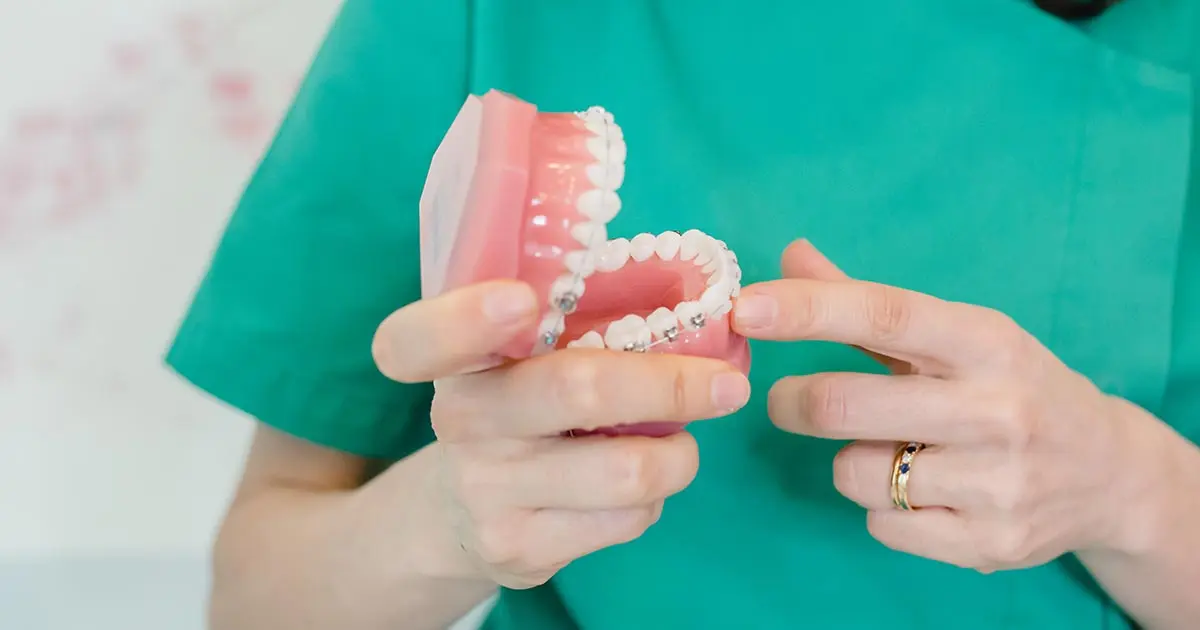 Recommendations for orthodontic treatment with aligners