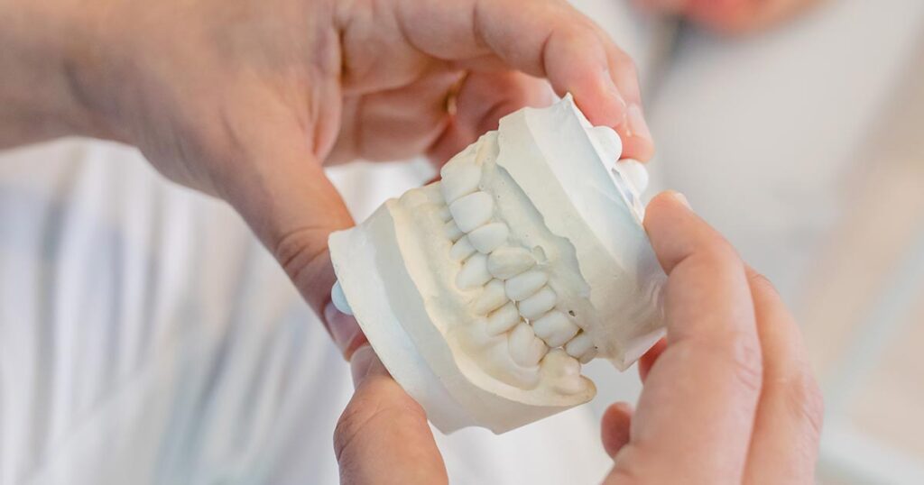implantes dentarios implantologia em Lisboa