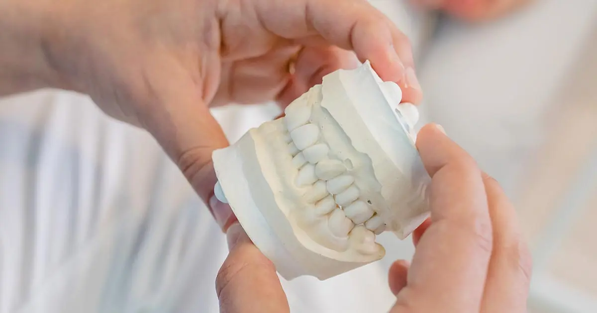 What is the purpose of dental implants?