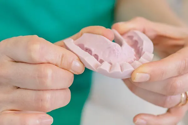 Implantologia, implantes dentários