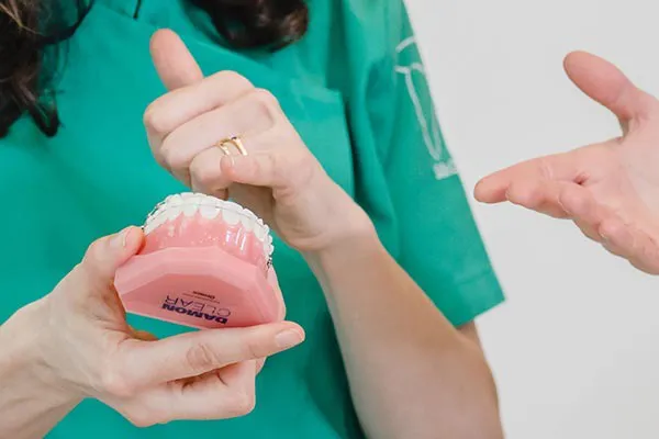 Ortodontia, aparelho fixo