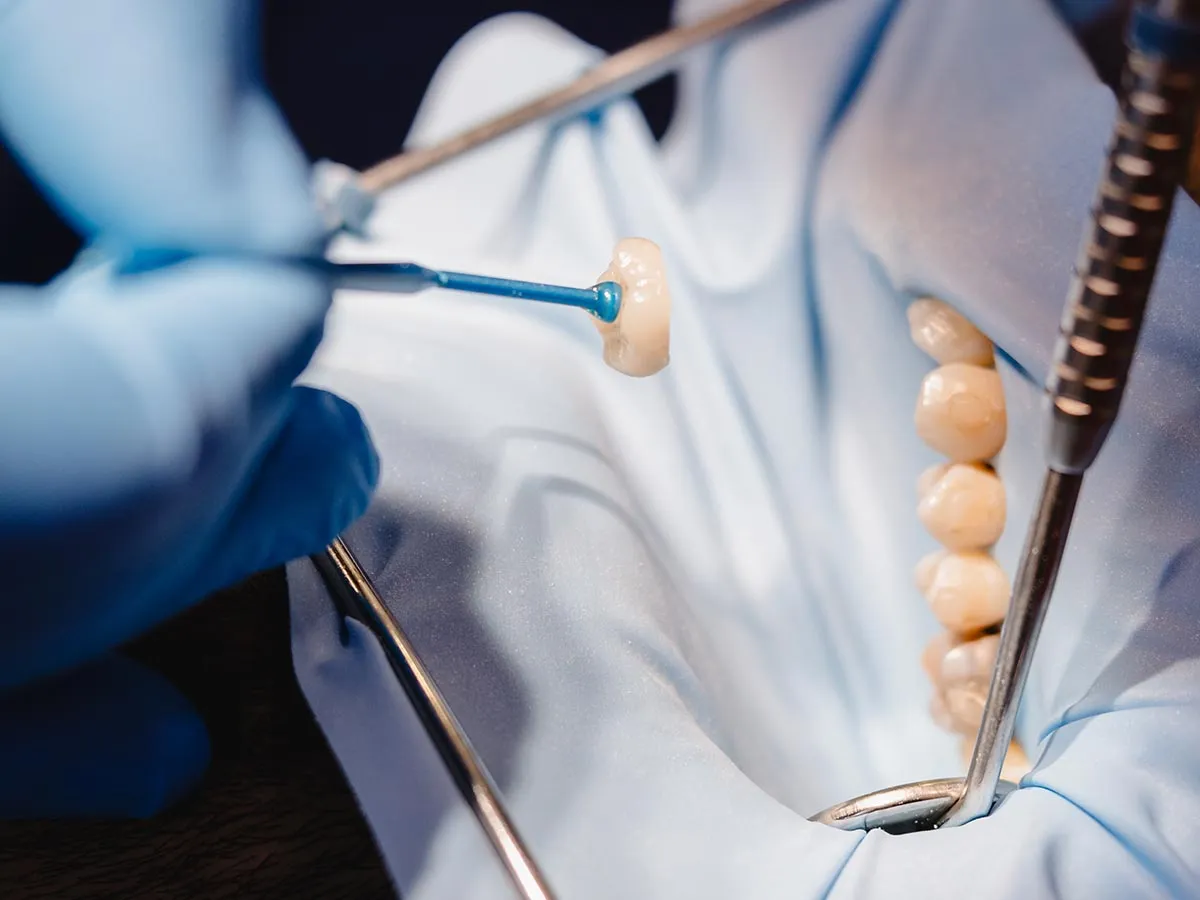 Prostodontia, prótese dentária